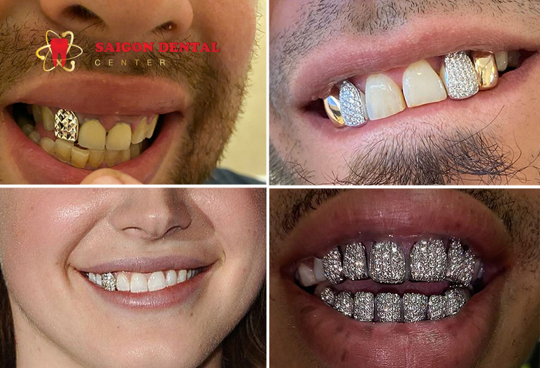 some case for diamond teeth