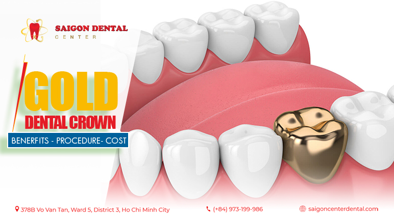 Gold Dental Crown