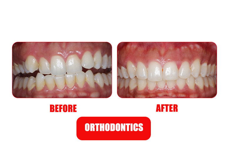 orthodontic
