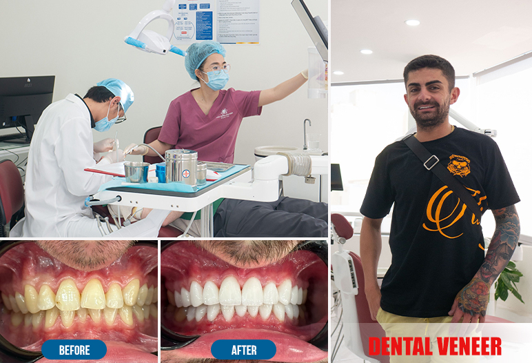 dental cosmetic in Vietnam