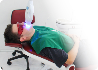 teeth-whitening-in-office