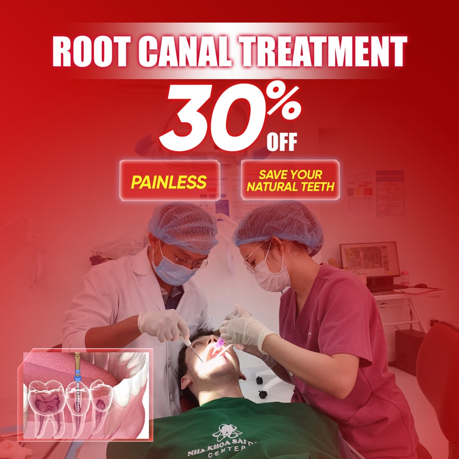 root canal treatment