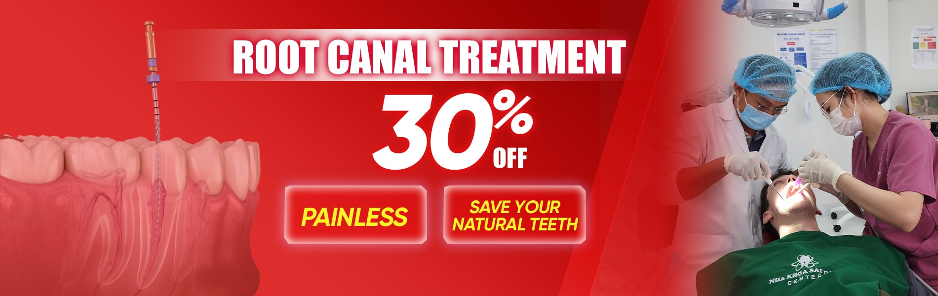 root canal treatment