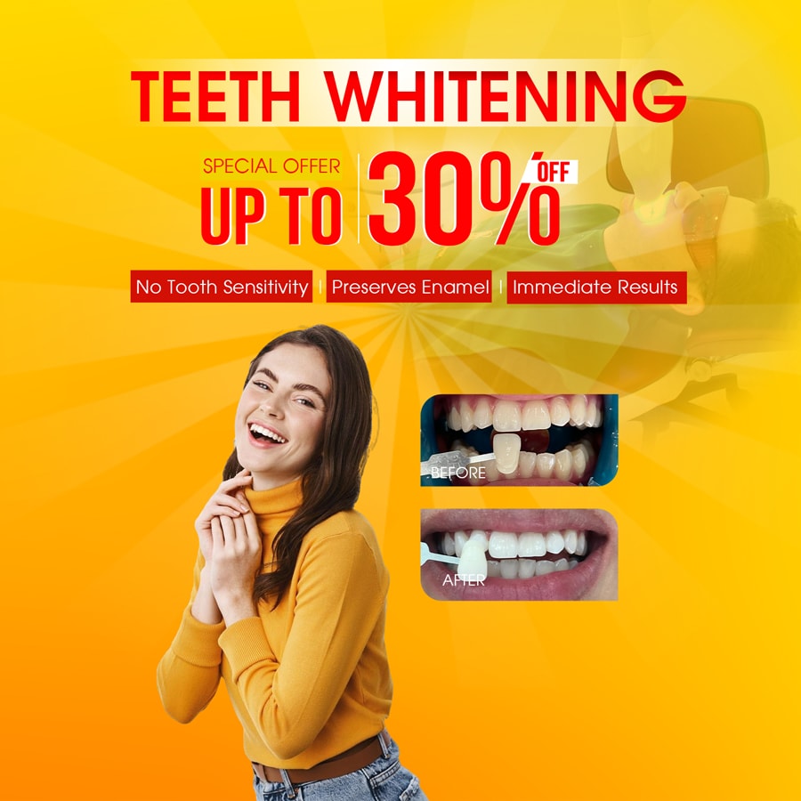 zoom whitening teeth