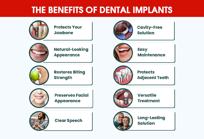 The benefits of dental implants