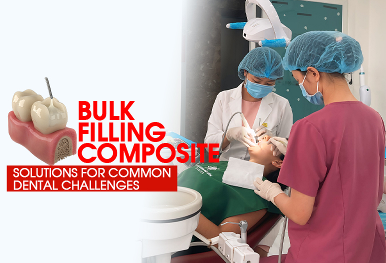 bulk filling composite