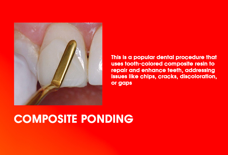 composite bonding teeth