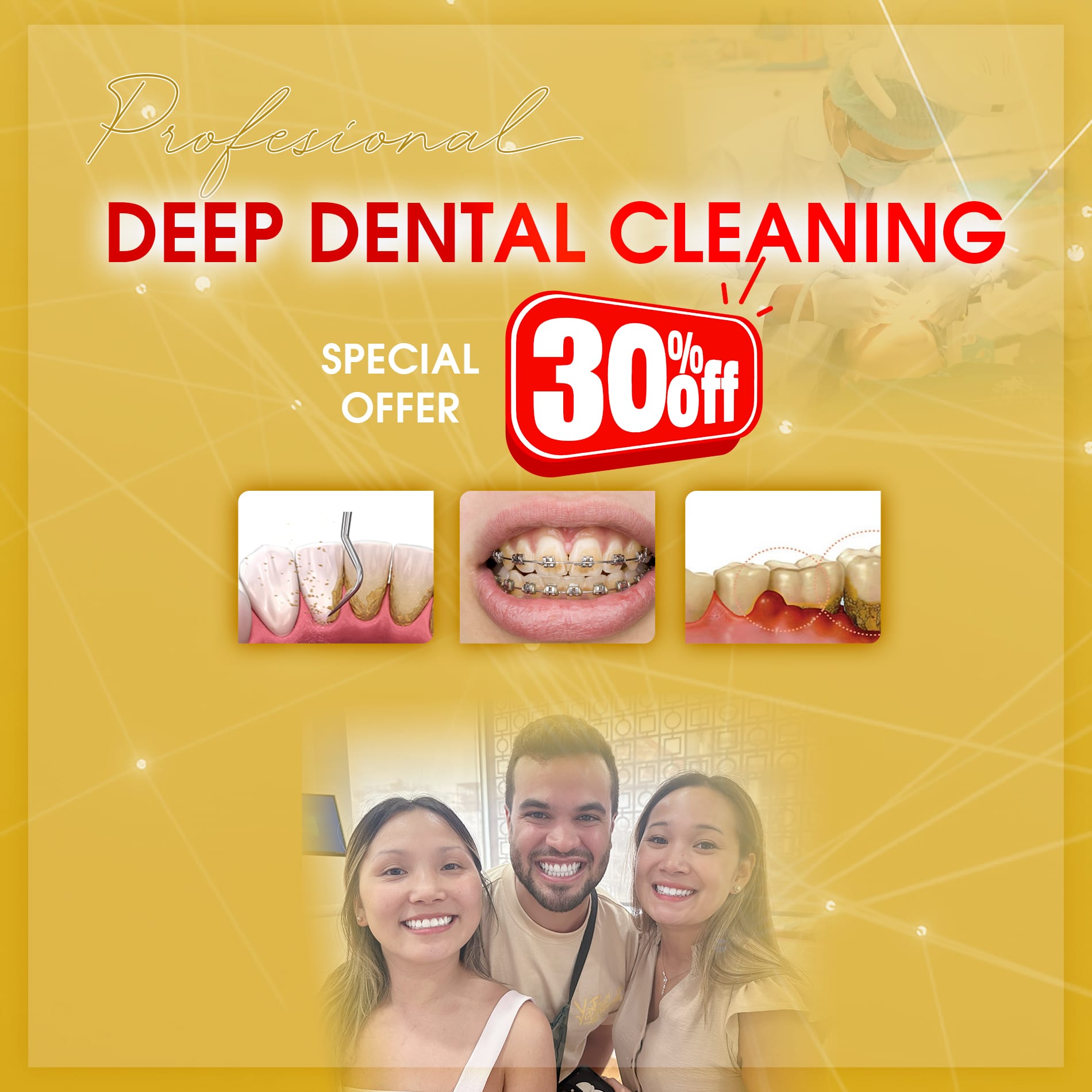 deep cleaning of teeth