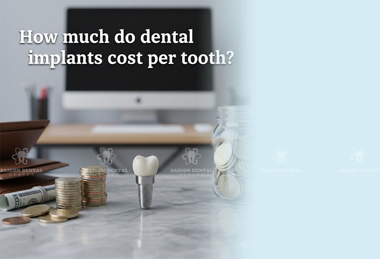How much do dental implants cost per tooth?