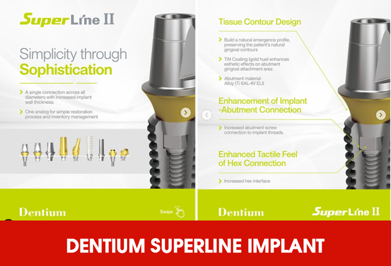 dentium superline implant