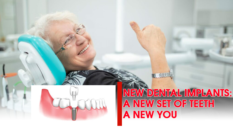 new dental implants