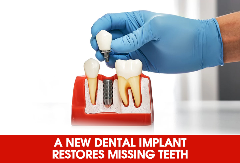 a new set of teeth with dental implants