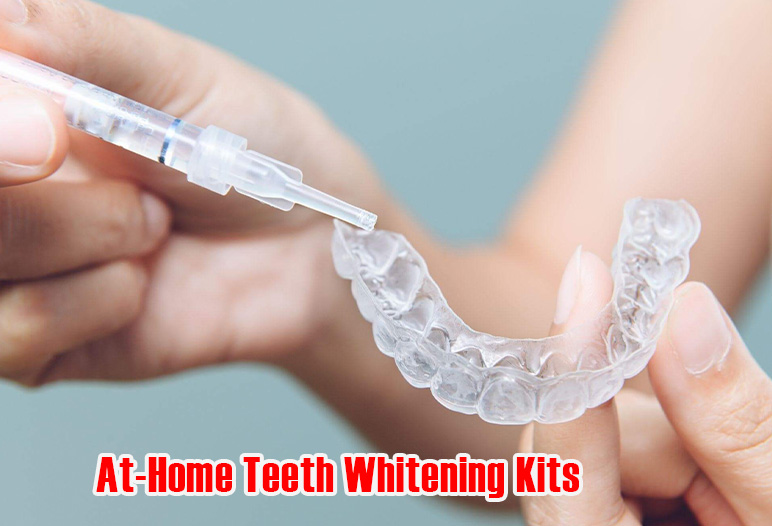 At-home teeth whitening kits