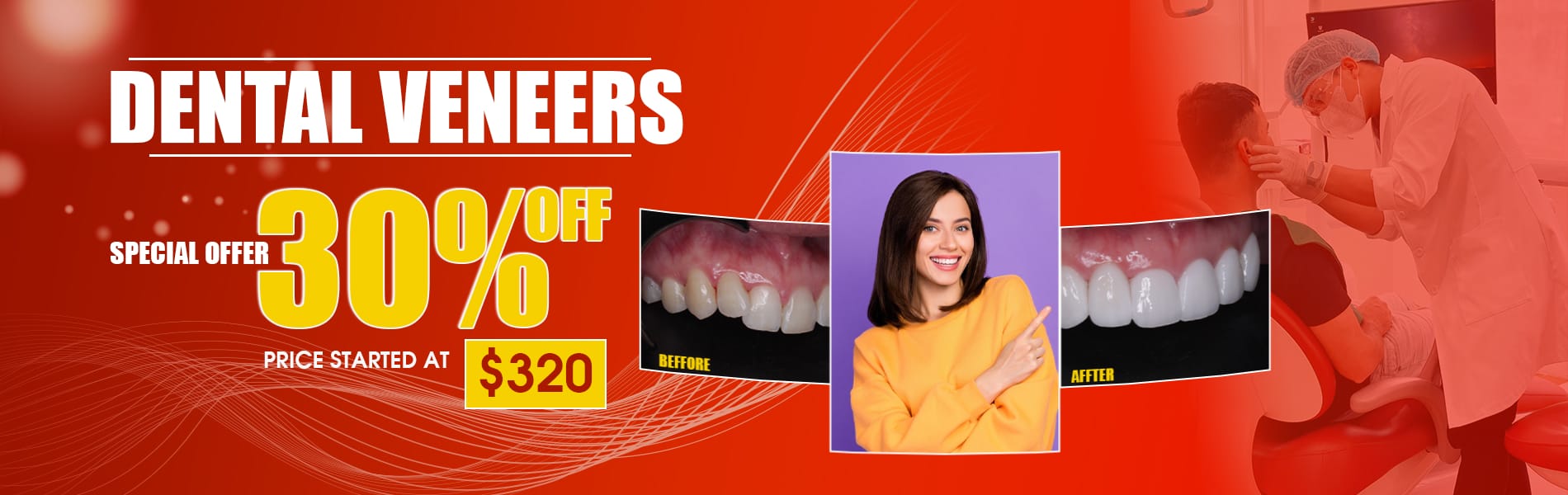 best dental veneers