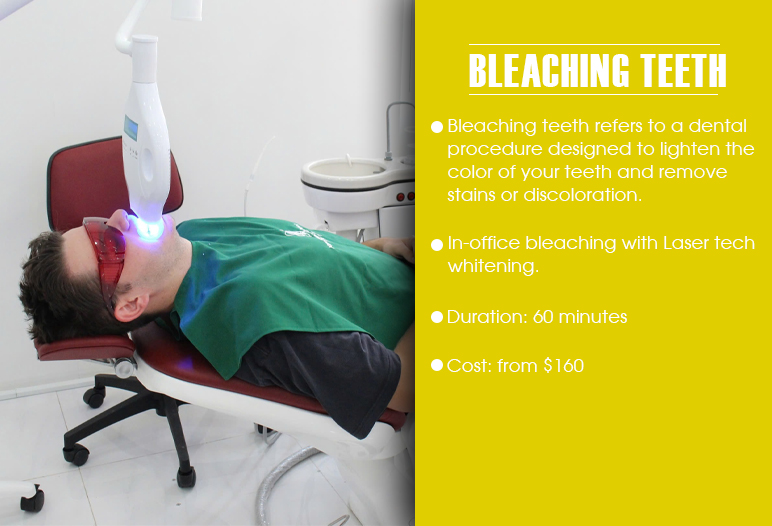 bleaching treatment for teeth