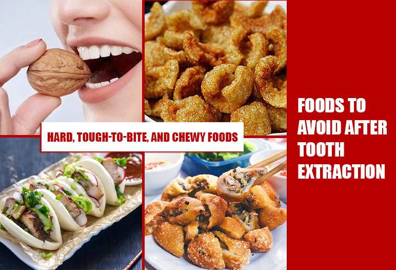 food avoid after tooth extraction