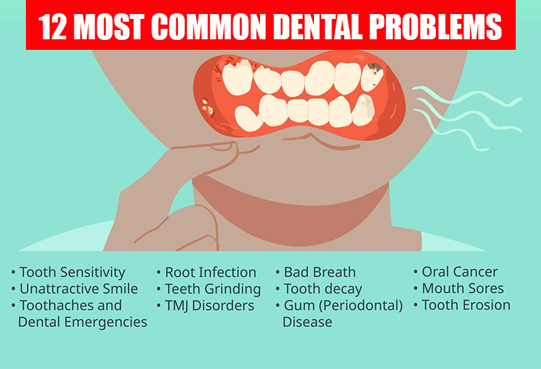 common teeth problems