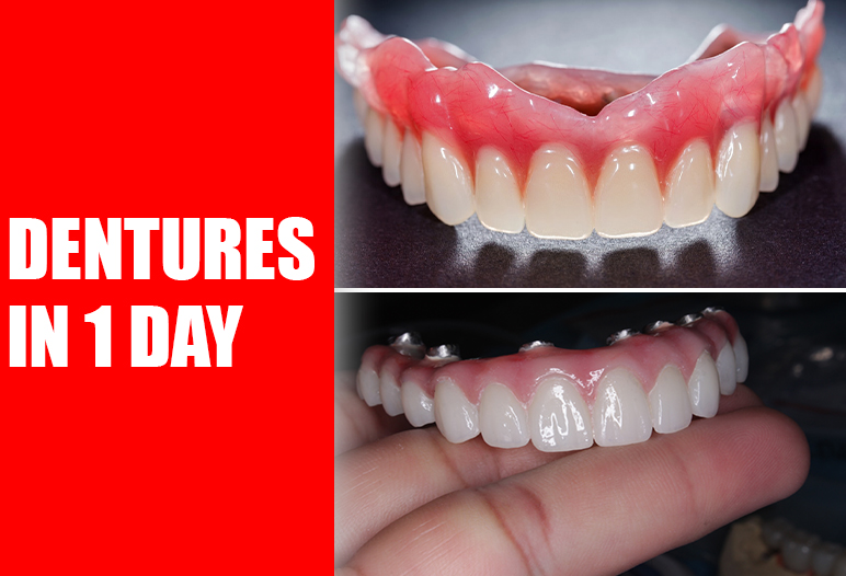 same day false teeth