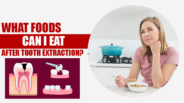 what foods can i eat after tooth extraction