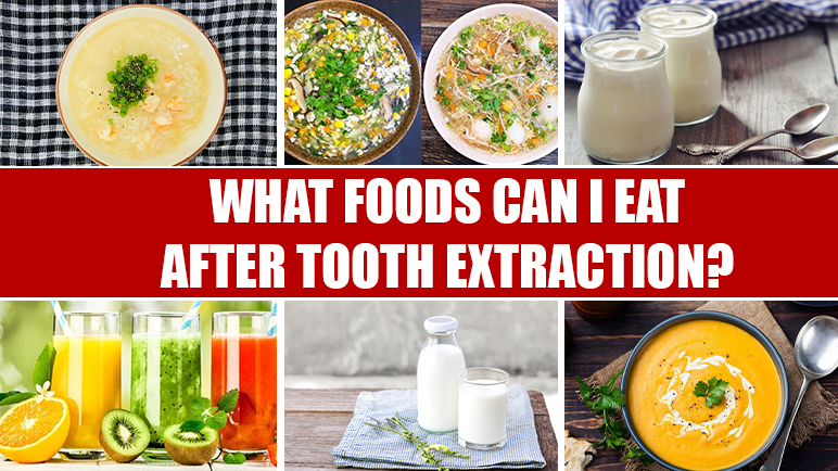 soft foods to eat after tooth extraction