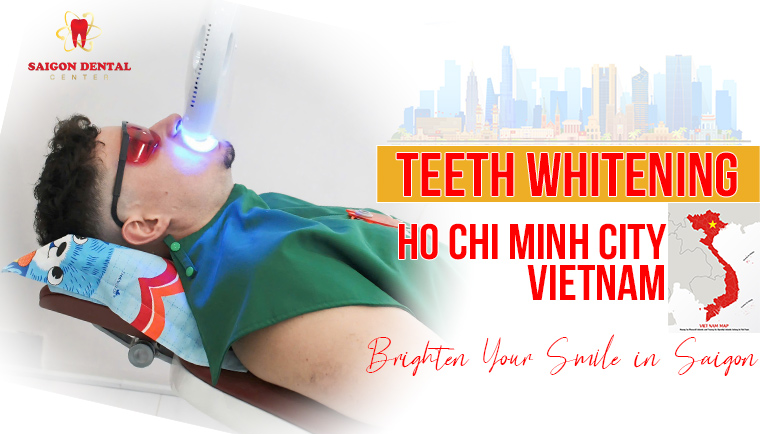 teeth whitening hcmc