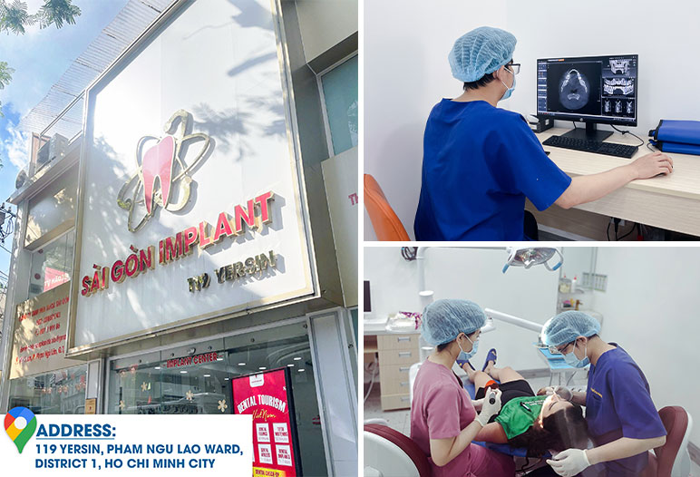 best dental implant clinic