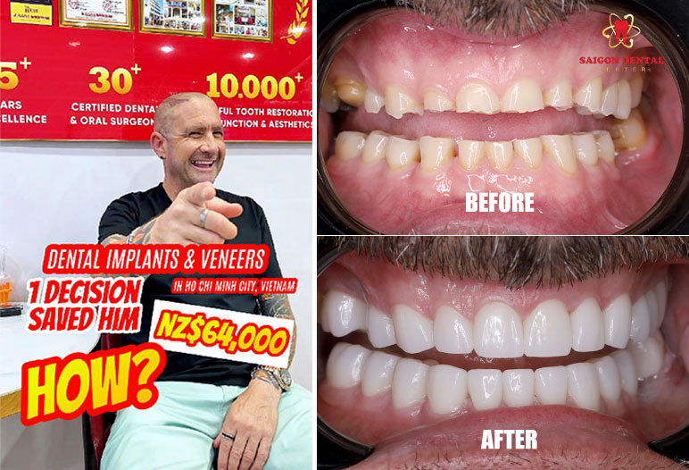 best dental clinic vietnam