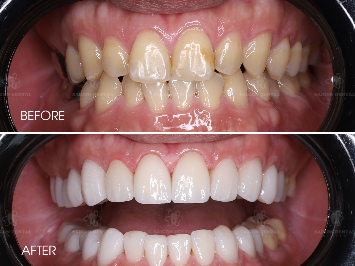 cosmetic dentistry