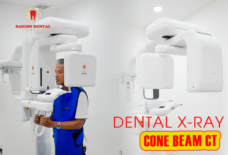 dental-xray conebeam ct