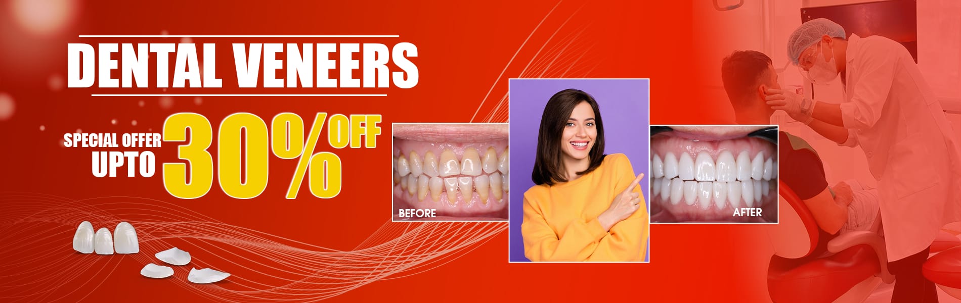 best dental veneers saigon