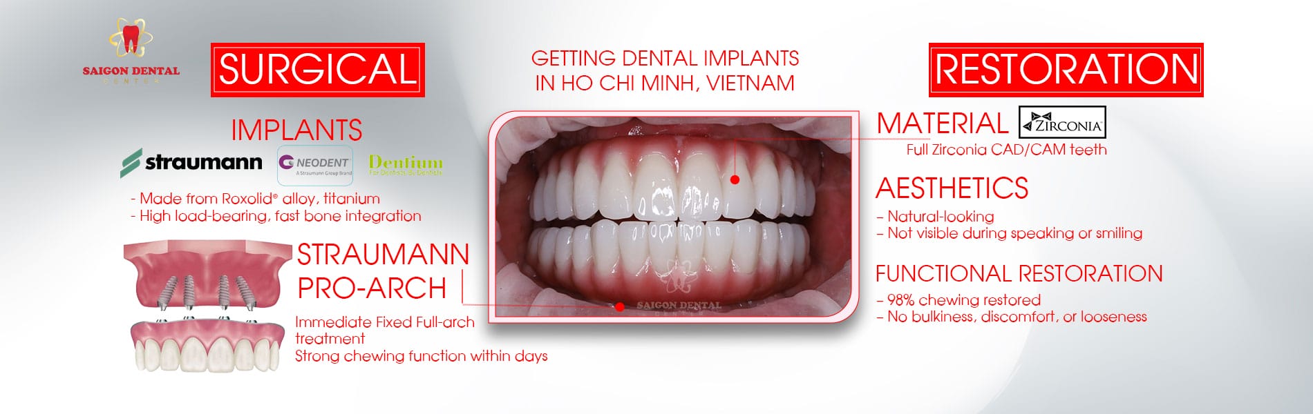 dental implant procedure
