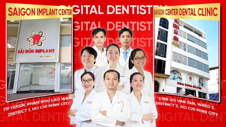 Definitive Guide to Saigon Center Dental Clinic Saigon Implant Center