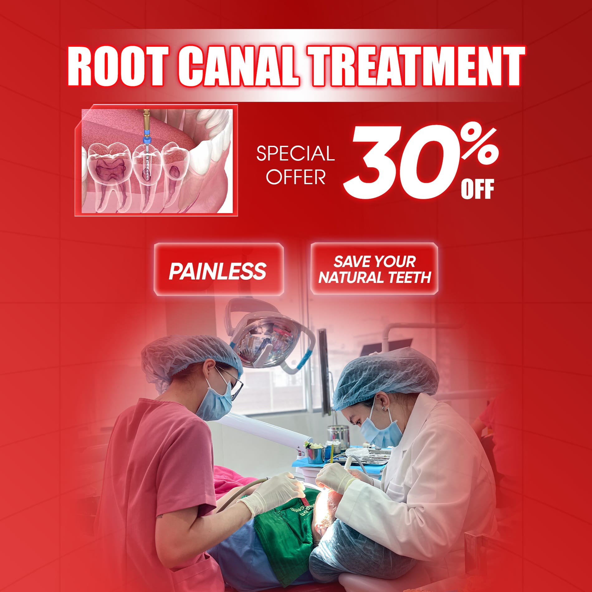 root canal treatment