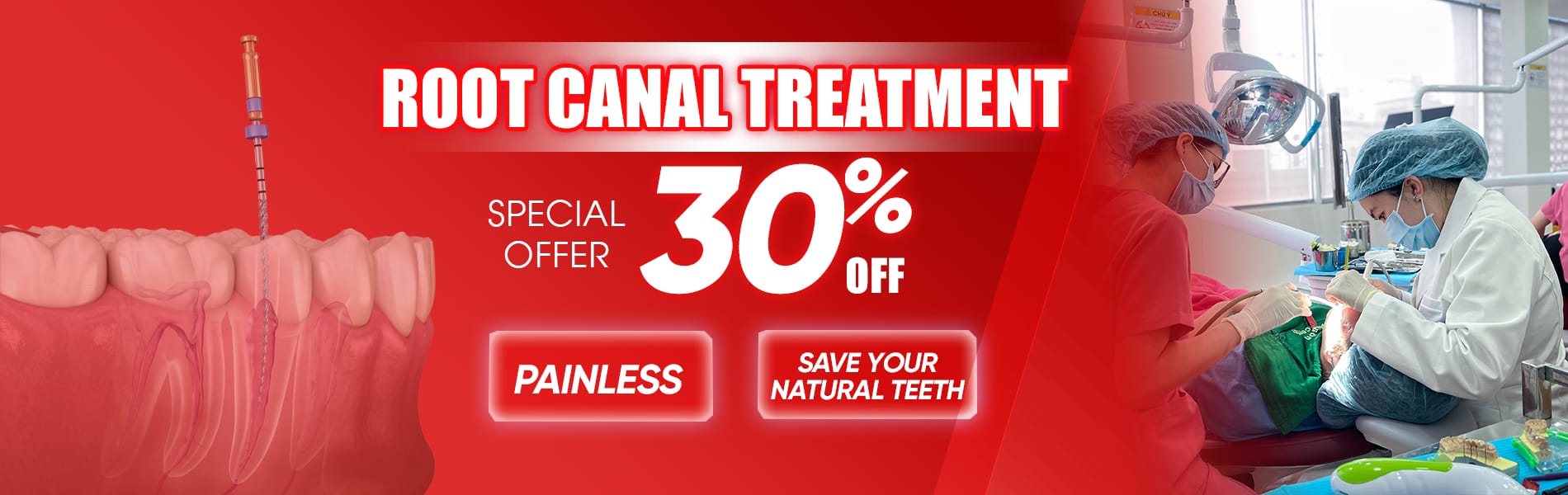 root canal treatment