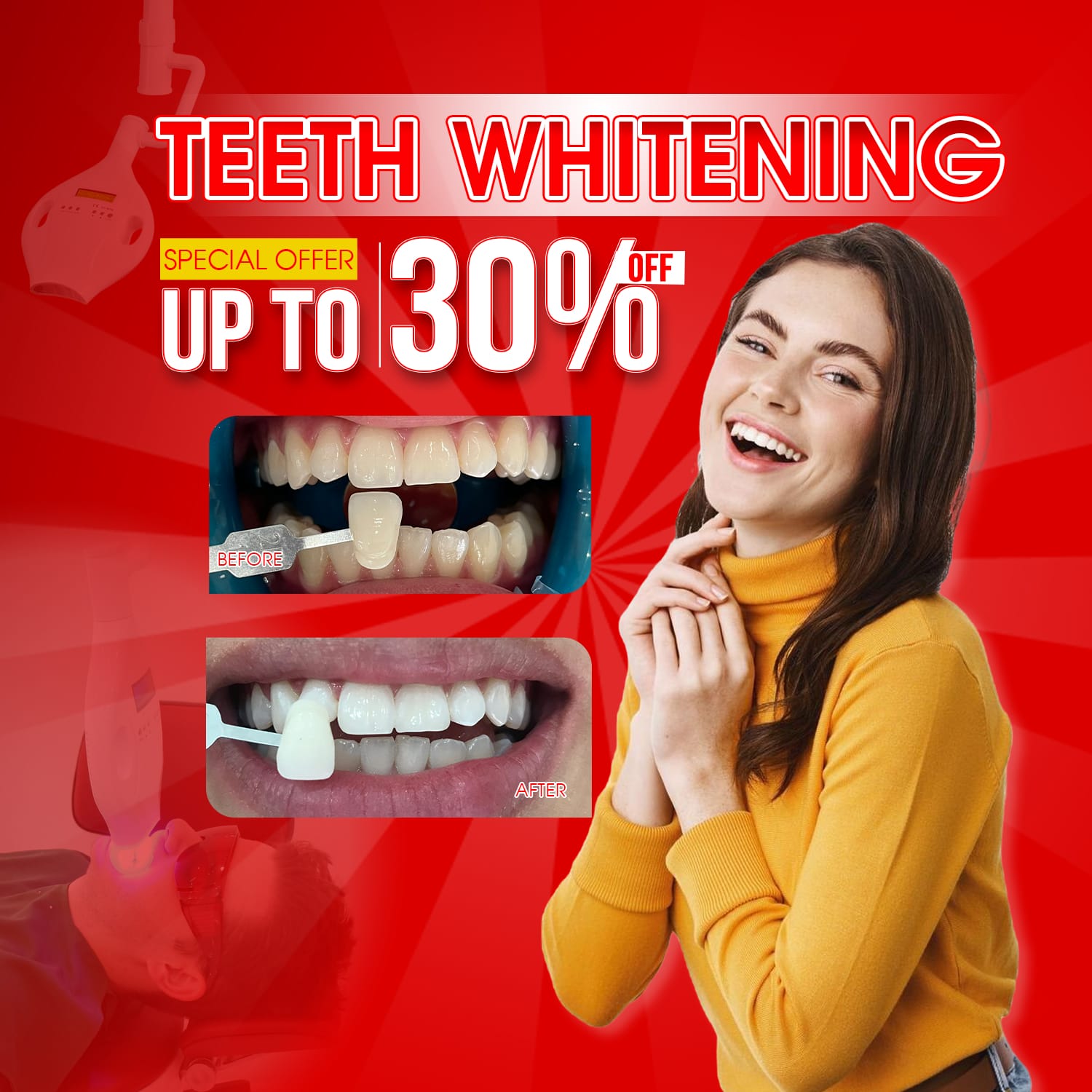 best teeth whitening in ho chi minh city