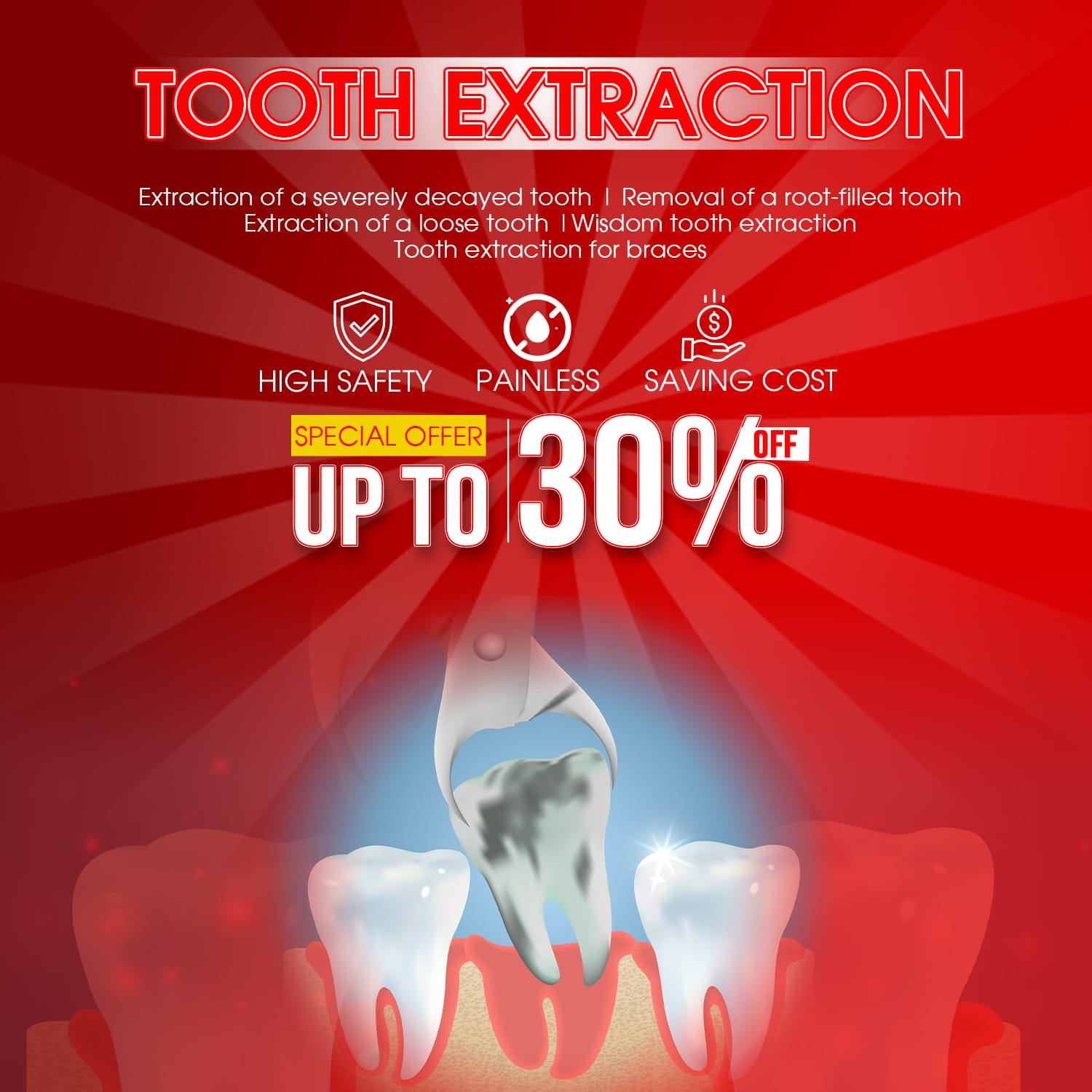 tooth extraction
