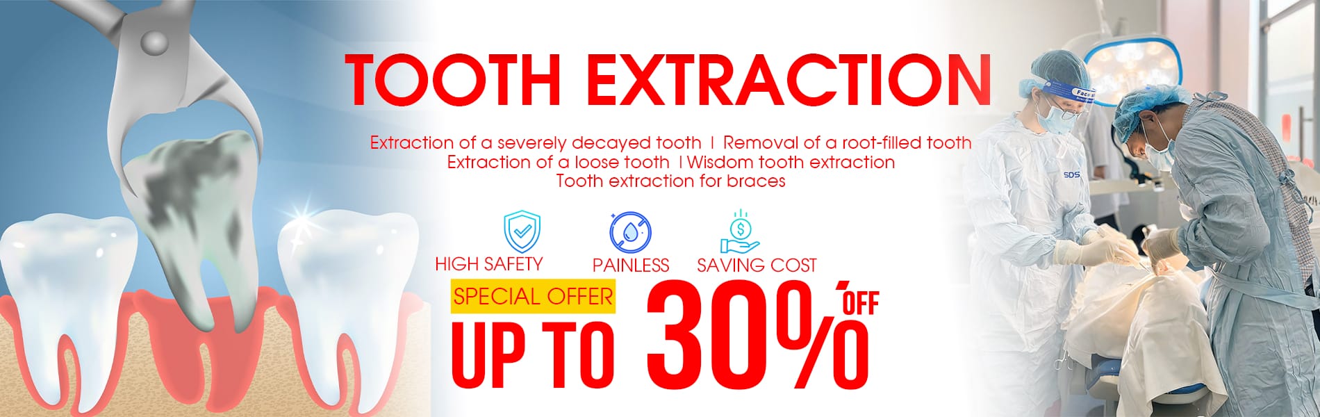 tooth extration