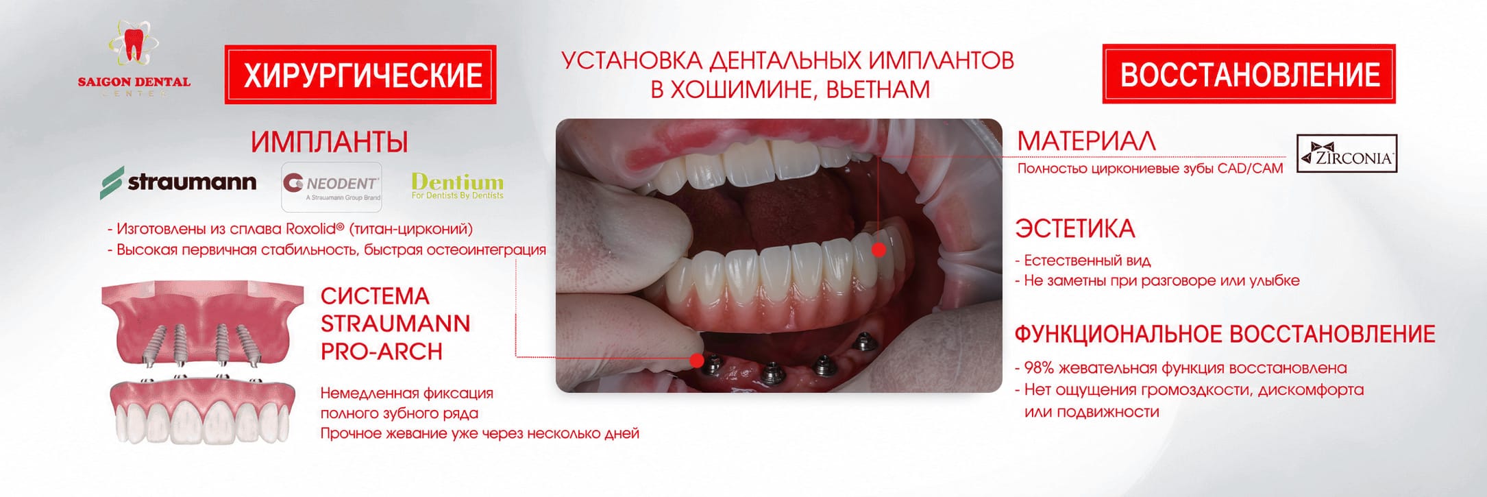 dental implant material 1