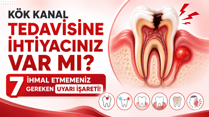 Kanal Tedavisine Ihtiyacim Var mi Goz Ardi Etmemeniz Gereken 7 Uyari Isareti new