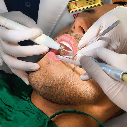dental cleaning