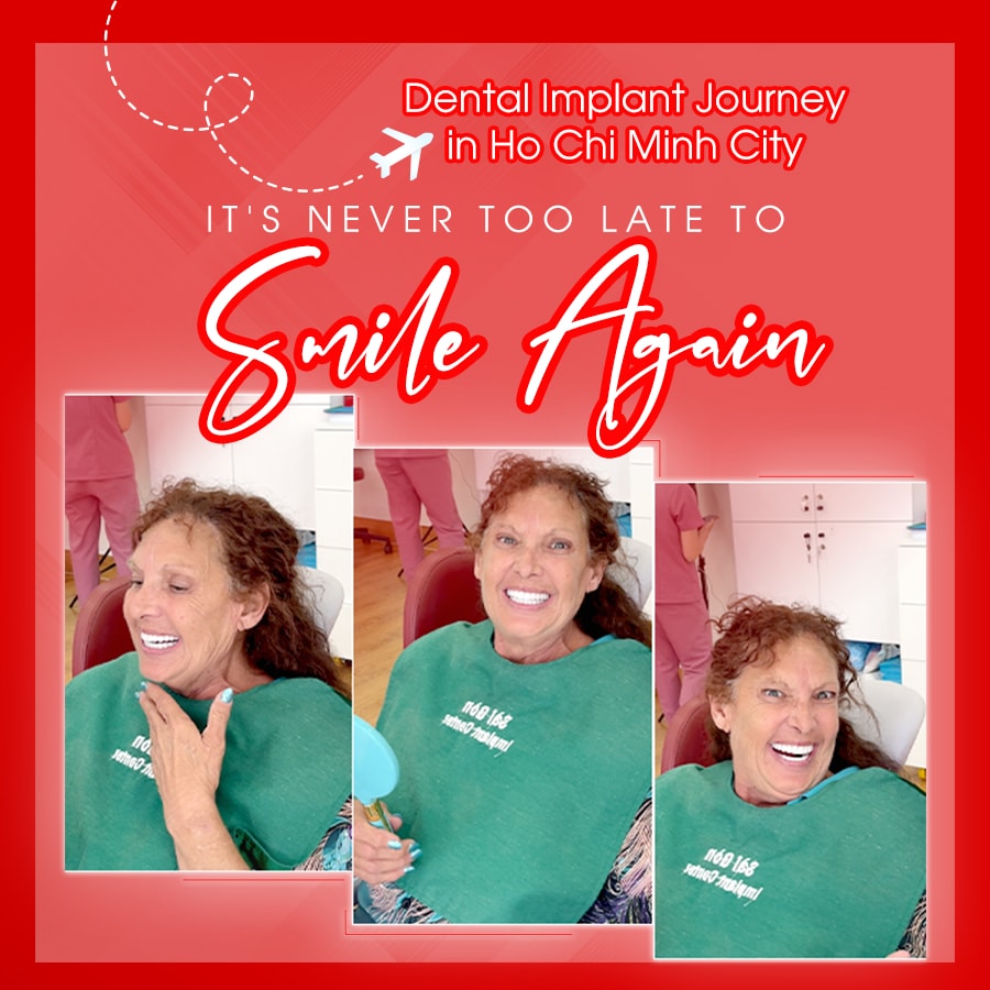 dental implant journey mobile