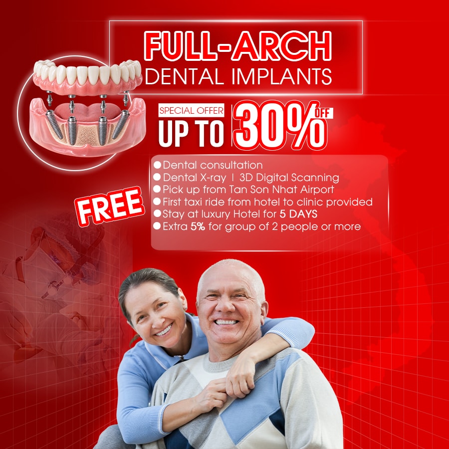 best all-on-4 dental implants in ho chi minh