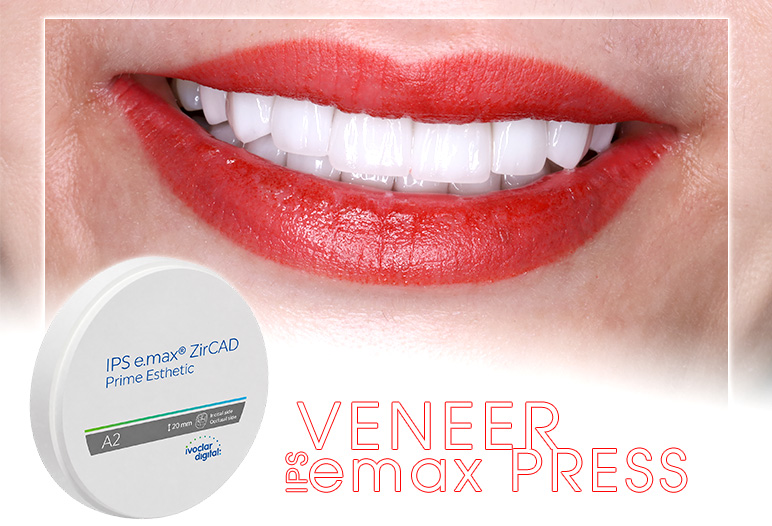 porcelain veneer emax press