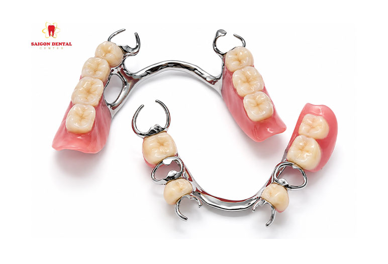 cost of dentures