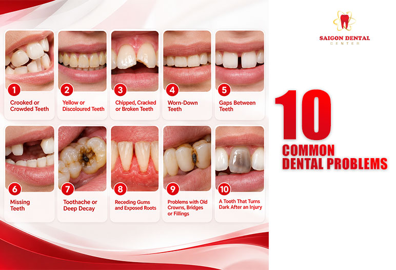 dental problems